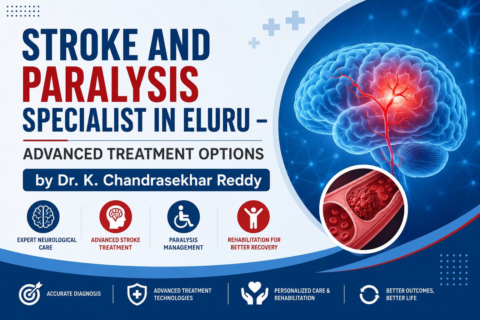 Stroke and Paralysis Specialist in Eluru – Advanced Treatment Options | Dr. Kalakoti Chandra Sekhar Reddy – Expert Neurologist