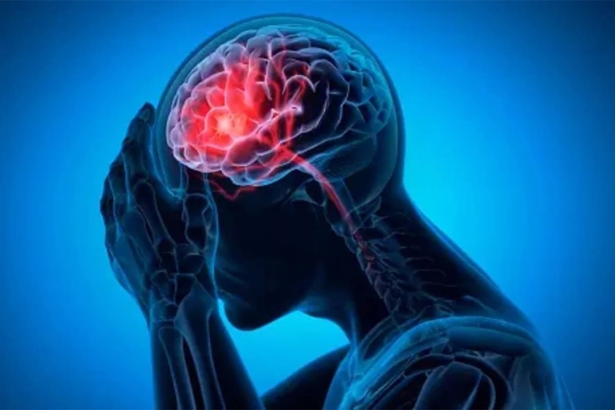 Dr. Kalakoti Chandra Sekhar Reddy | Best Neurologist
