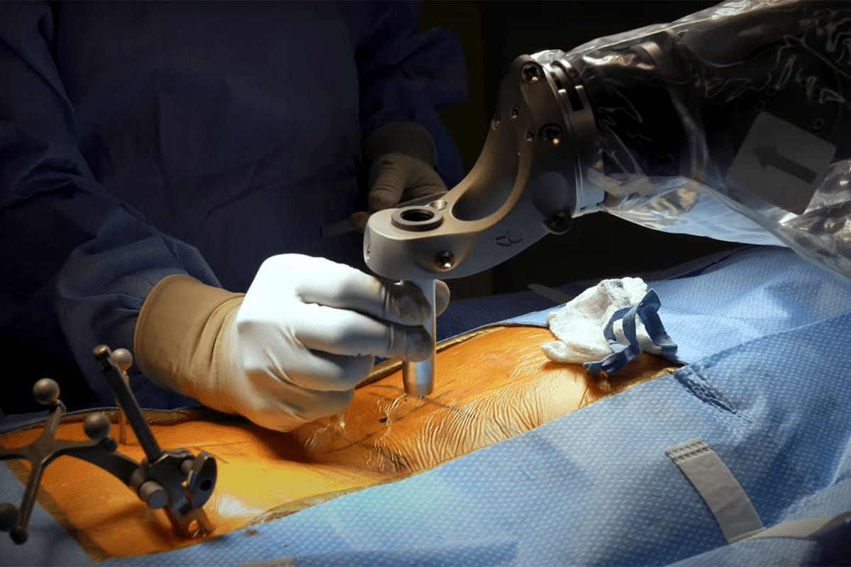 Spine Surgery | Dr. Kalakoti Chandra Sekhar Reddy - Best Neurologist